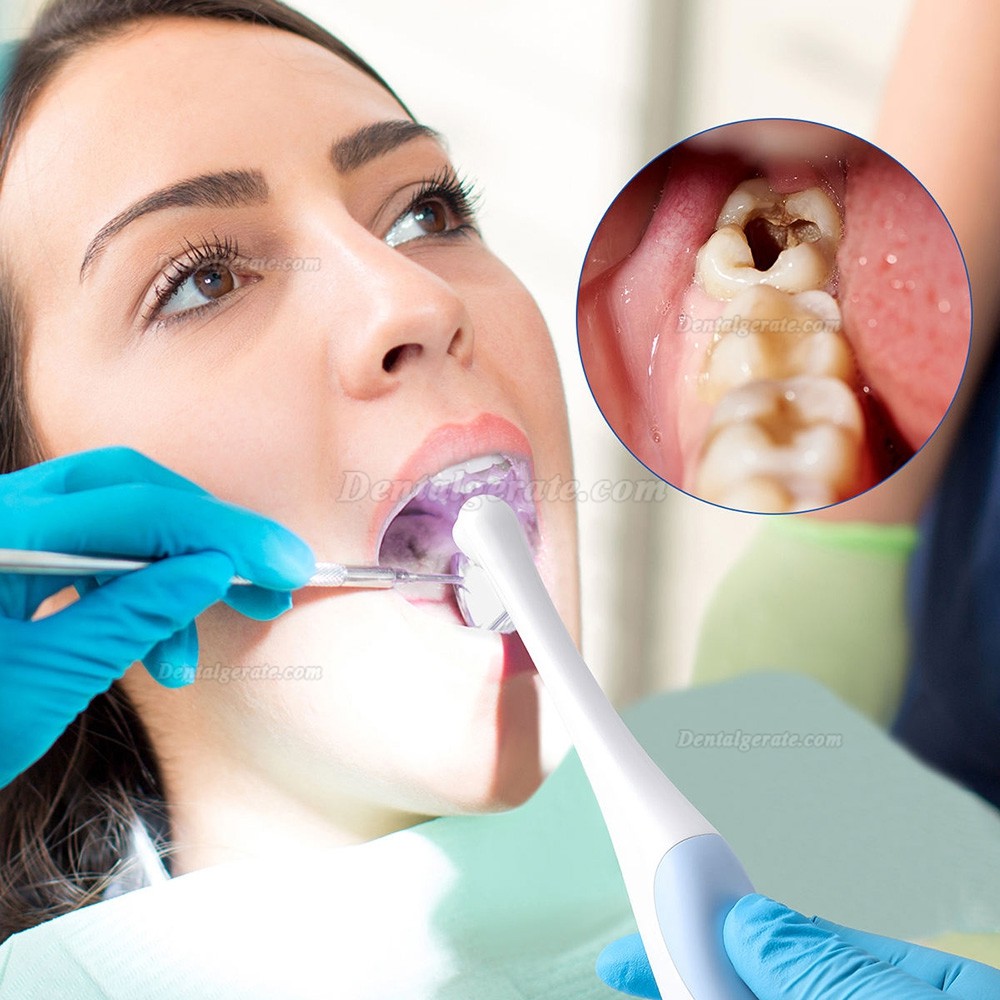 Dental Digitale Intraoralkamera Typ-C /Micro USB 2in1, 2,0MP Pixel